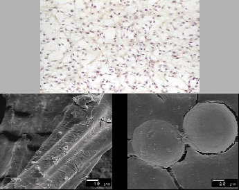 \begin{figure}\begin{center}
\leavevmode
\epsfxsize =2in \epsffile{chondrocytes.ps}\hskip 0.1in\epsfxsize =3in \epsffile{fibers.ps}
\end{center}
\end{figure}